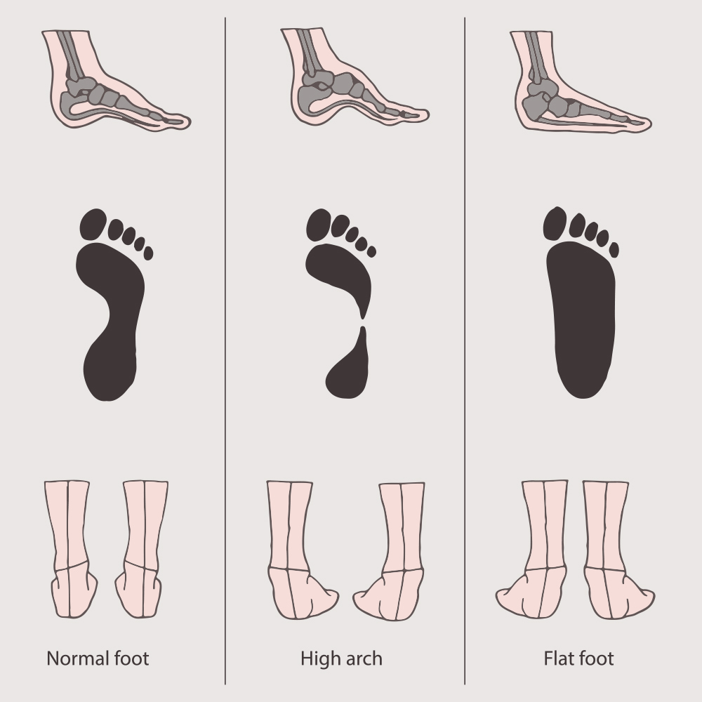 chiropractor-orthotics-info