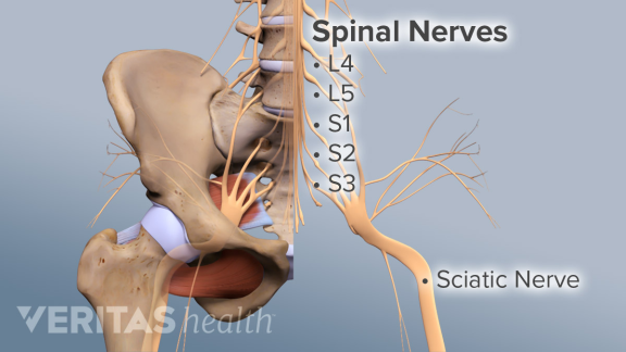 What Is Sciatica And How A Chiropractor Can Help Treat It